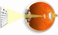 Астигматизм / Офтальмология Охрана и коррекция зрения