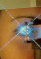 Лазерная коррекция зрения / Офтальмология Охрана и коррекция зрения